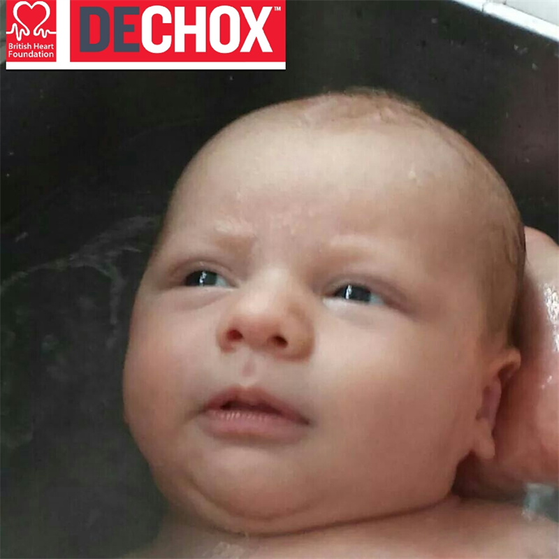 Dechox 2019